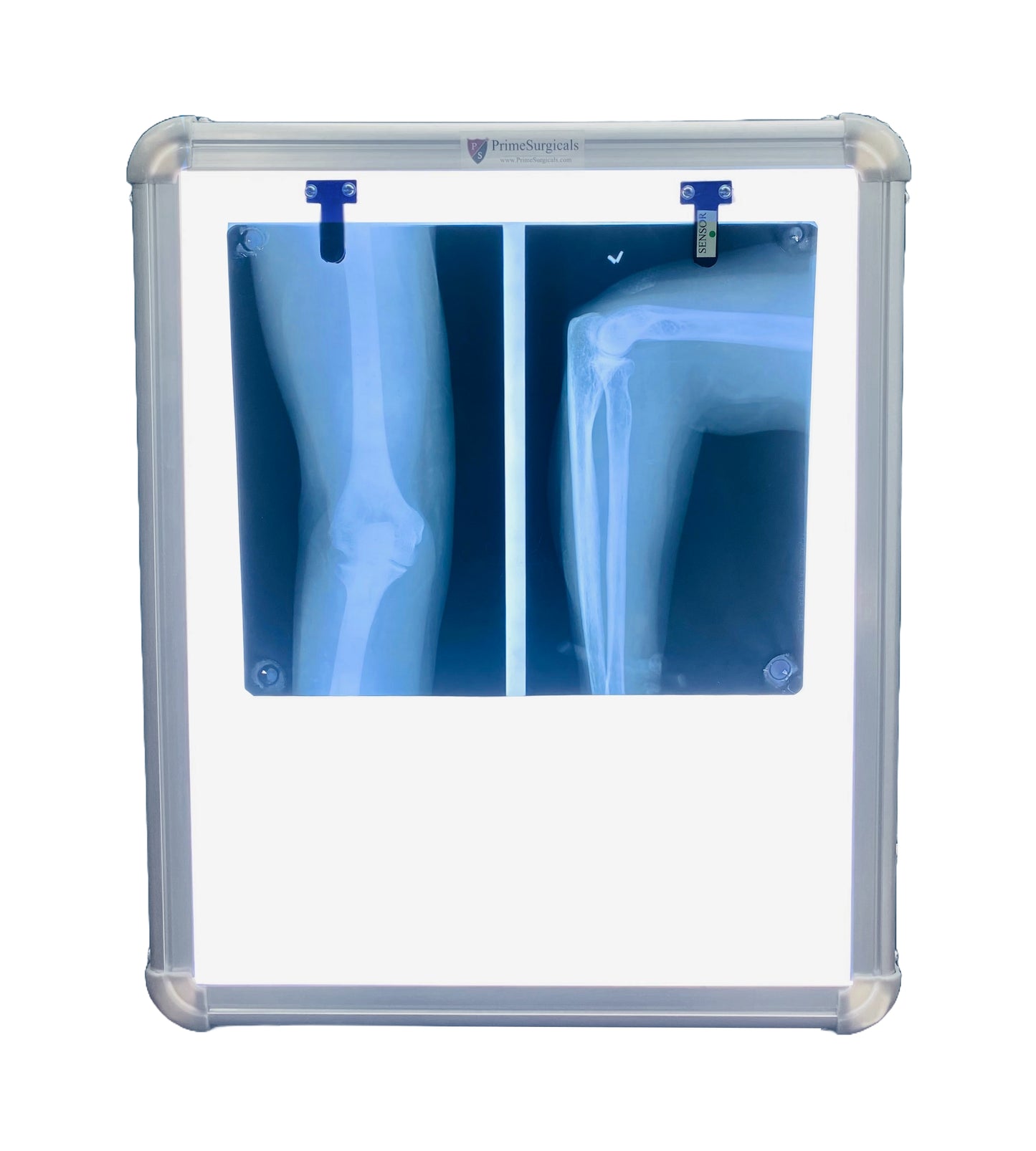 LED X-ray Viewer box - with Auto Sensor - with Dimmer - Silver Frame Single Film